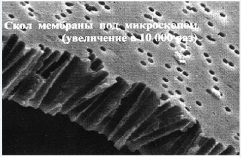 Membrana filtra